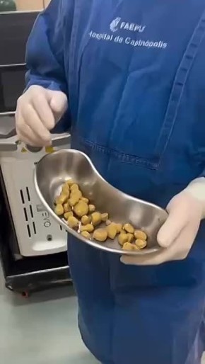    23         :      35 
