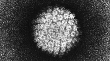 Вирус папилломы уходит в прошлое