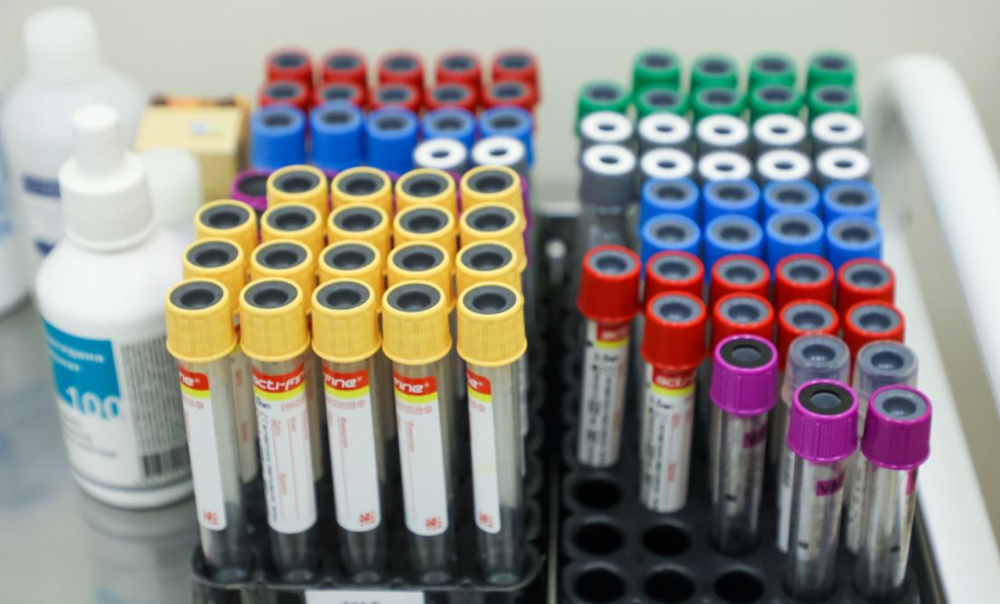 В России начнут бесплатно проверять риски раннего старения